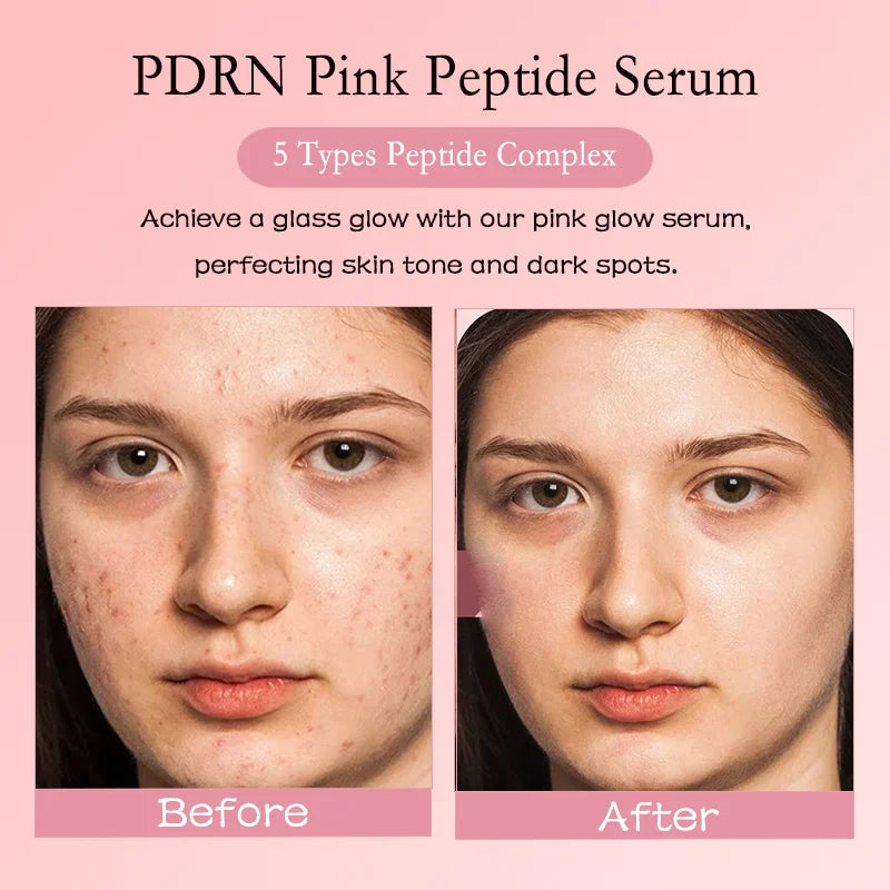 PDRN Salmon DNA Facial Serum Anti-Wrinkle Whitening Face Essence Pore Shrinking Wrinkle Vegan Firming Korean Skincare a